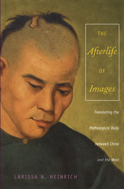 The Afterlife of Images : Translating the Pathological Body between China and the West, PDF eBook