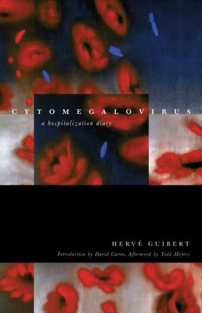 Cytomegalovirus : A Hospitalization Diary, Paperback / softback Book