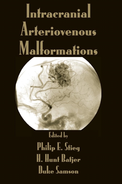 Intracranial Arteriovenous Malformations, Hardback Book