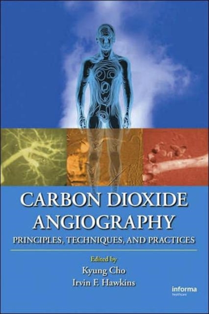 Carbon Dioxide Angiography : Principles, Techniques, and Practices, Hardback Book