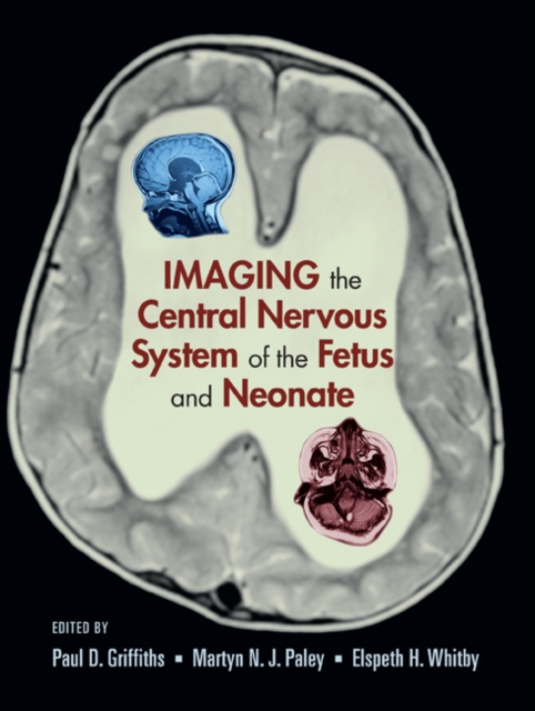 Imaging the Central Nervous System of the Fetus and Neonate, Hardback Book