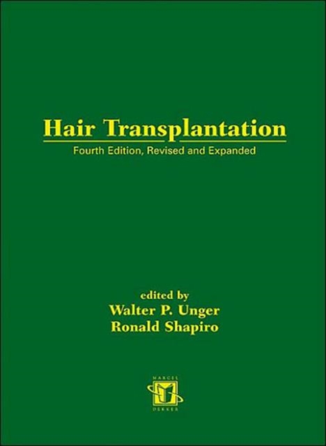 Hair Transplantation, Fourth Edition, Hardback Book