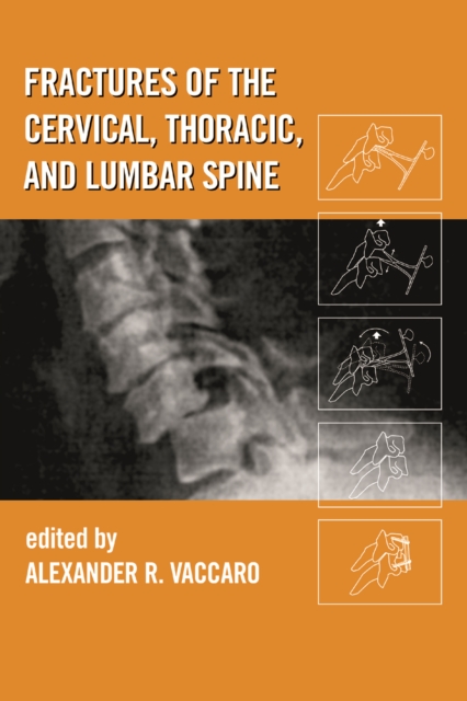 Fractures of the Cervical, Thoracic, and Lumbar Spine, PDF eBook