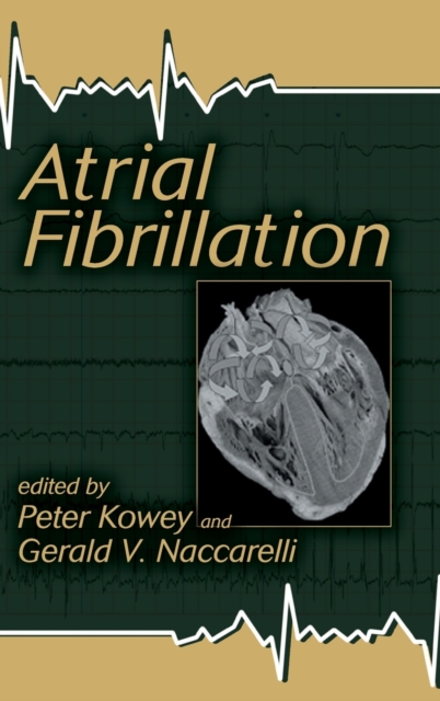 Atrial Fibrillation, Hardback Book