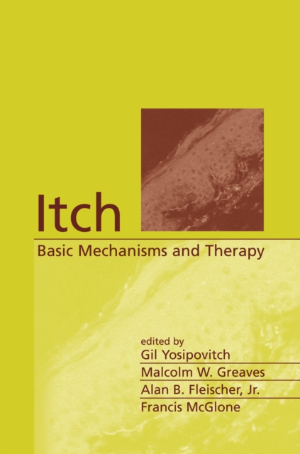Itch : Basic Mechanisms and Therapy, PDF eBook