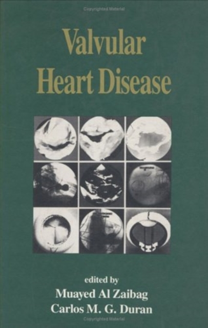 Valvular Heart Disease, Hardback Book