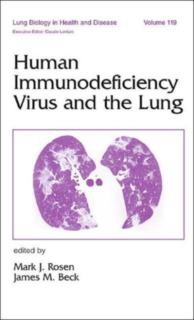 Human Immunodeficiency Virus and the Lung, Hardback Book
