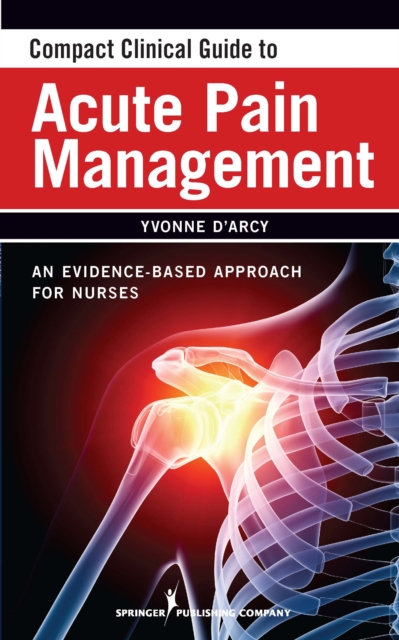 Compact Clinical Guide to Acute Pain Management : An Evidence-Based Approach, Paperback / softback Book