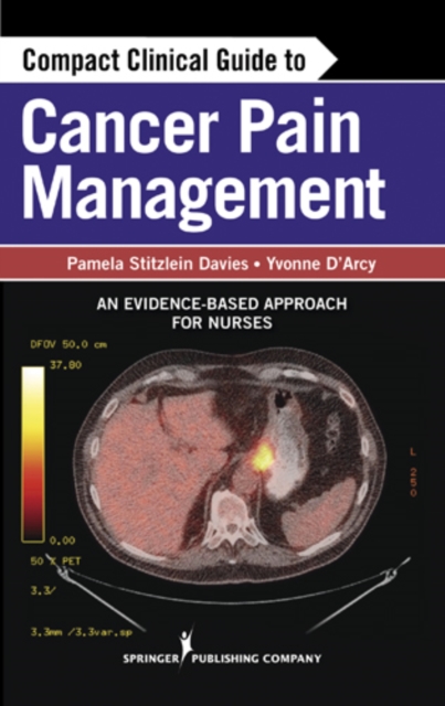 Compact Clinical Guide to Cancer Pain Management : An Evidence-Based Approach for Nurses, Paperback / softback Book