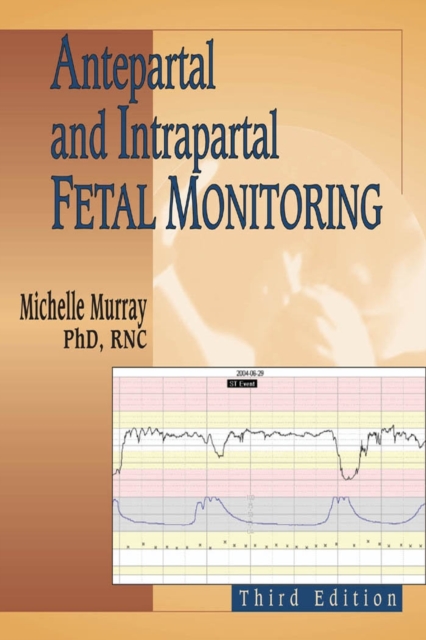 Antepartal and Intrapartal Fetal Monitoring, Paperback / softback Book