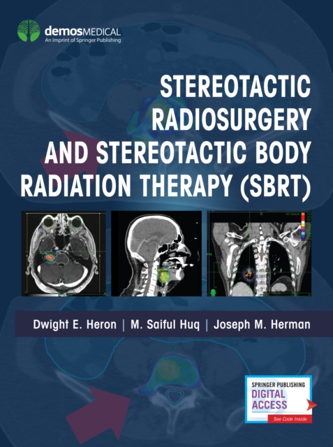 Stereotactic Radiosurgery and Stereotactic Body Radiation Therapy (SBRT), Hardback Book