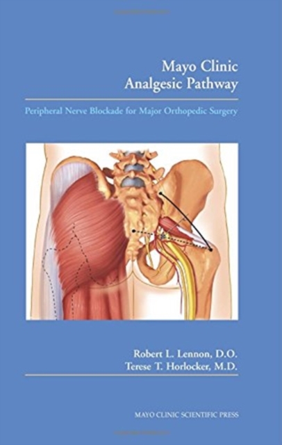 Mayo Clinic Analgesic Pathway : Peripheral Nerve Blockade for Major Orthopedic Surgery and Procedural Training Manual, Mixed media product Book