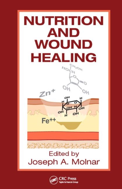 Nutrition and Wound Healing, Hardback Book