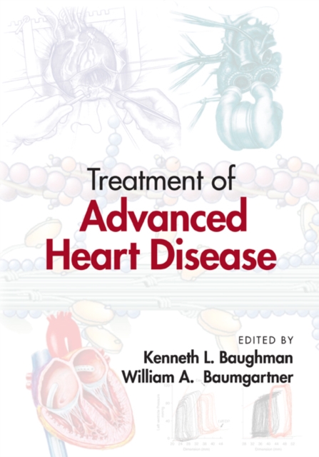Treatment of Advanced Heart Disease, Hardback Book