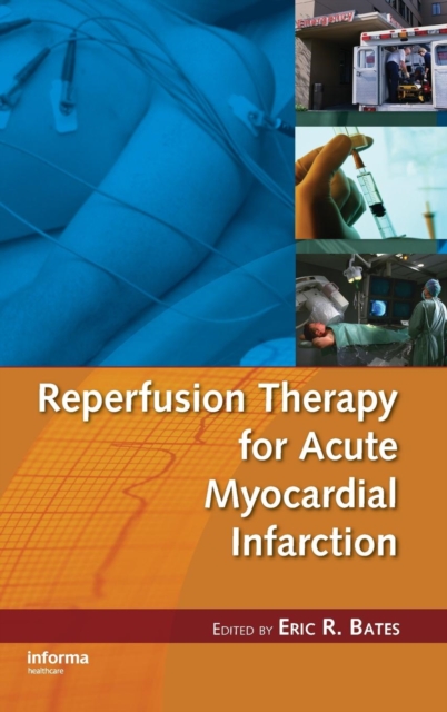 Reperfusion Therapy for Acute Myocardial Infarction, Hardback Book