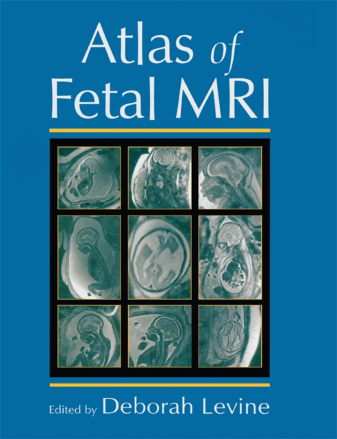 Atlas of Fetal MRI, PDF eBook