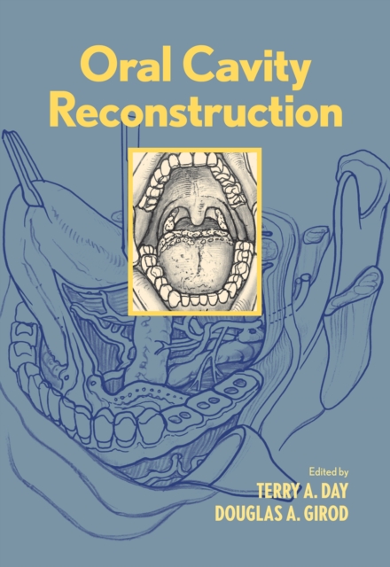 Oral Cavity Reconstruction, PDF eBook