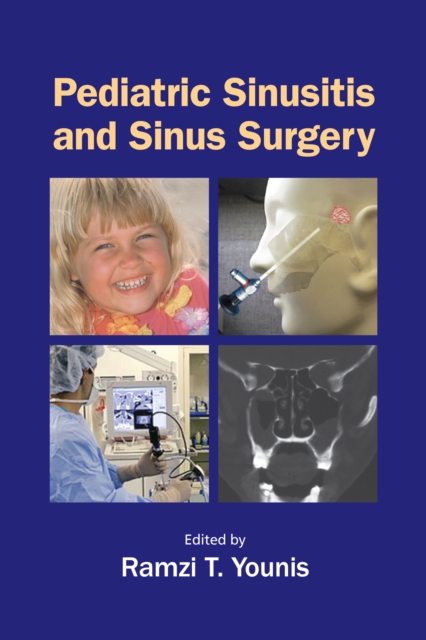 Pediatric Sinusitis and Sinus Surgery, PDF eBook