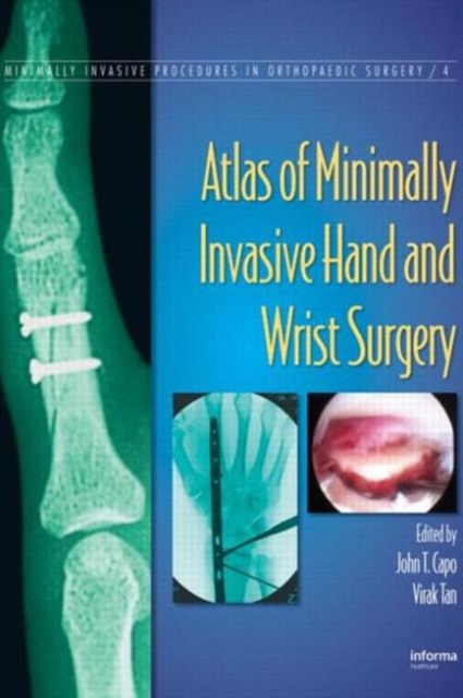 Atlas of Minimally Invasive Hand and Wrist Surgery, Hardback Book