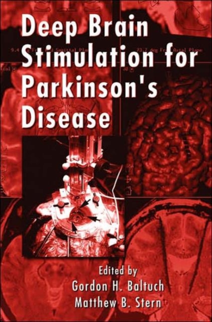 Deep Brain Stimulation for Parkinson's Disease, Hardback Book