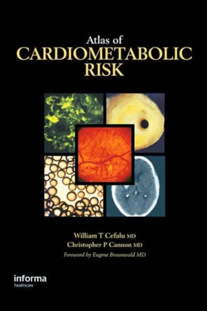 Atlas of Cardiometabolic Risk, Hardback Book