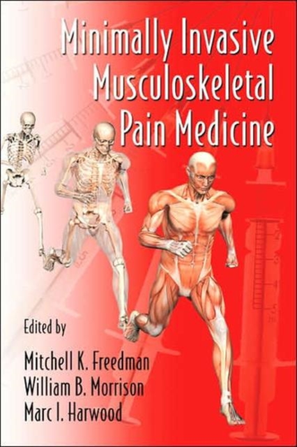Minimally Invasive Musculoskeletal Pain Medicine, Hardback Book