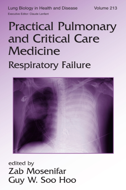 Practical Pulmonary and Critical Care Medicine : Respiratory Failure, PDF eBook