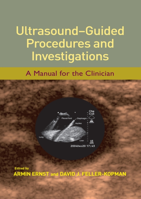 Ultrasound-Guided Procedures and Investigations : A Manual for the Clinician, PDF eBook