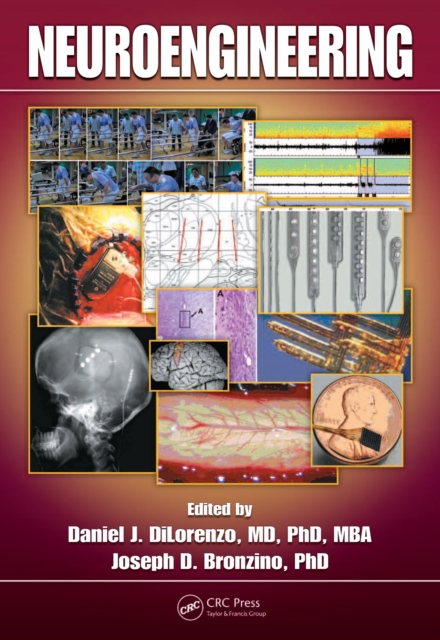 Neuroengineering, PDF eBook