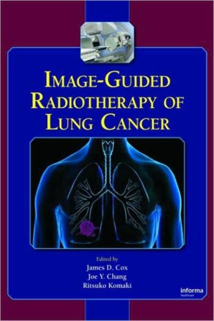 Image-Guided Radiotherapy of Lung Cancer, Hardback Book