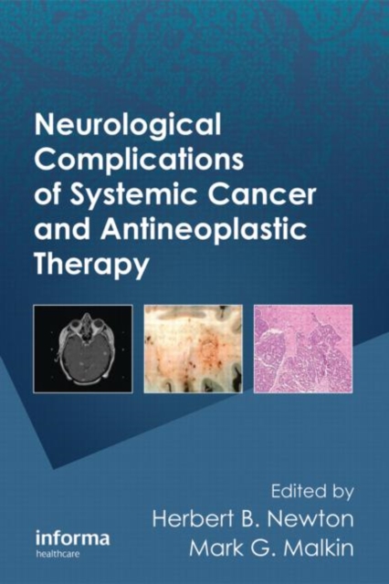 Neurological Complications of Systemic Cancer and Antineoplastic Therapy, Hardback Book