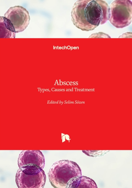 Abscess : Types, Causes and Treatment, Hardback Book