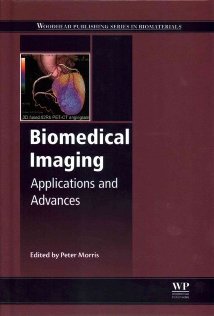 Biomedical Imaging : Applications and Advances, Hardback Book