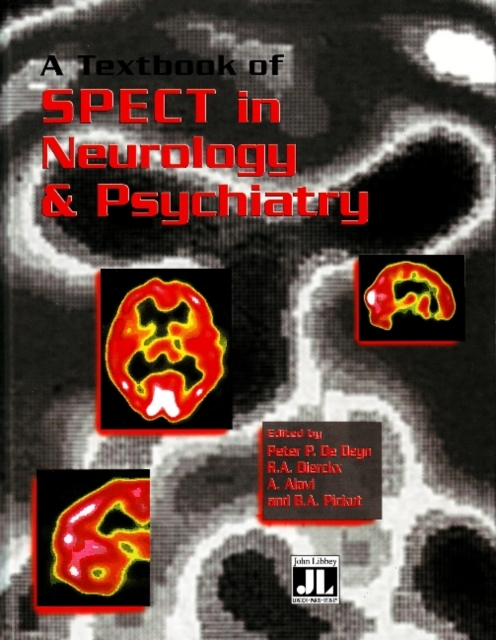 Textbook of SPECT in Neurology & Psychiatry, Paperback / softback Book
