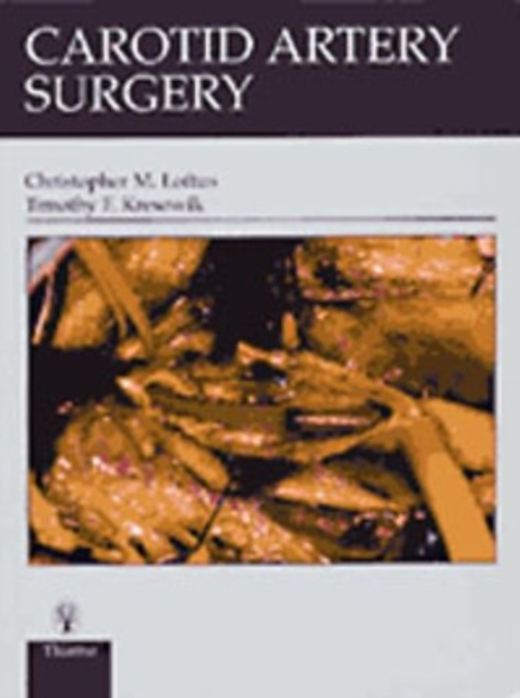 Carotid Artery Surgery, Hardback Book