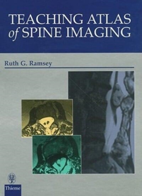 Teaching Atlas of Spine Imaging, Hardback Book