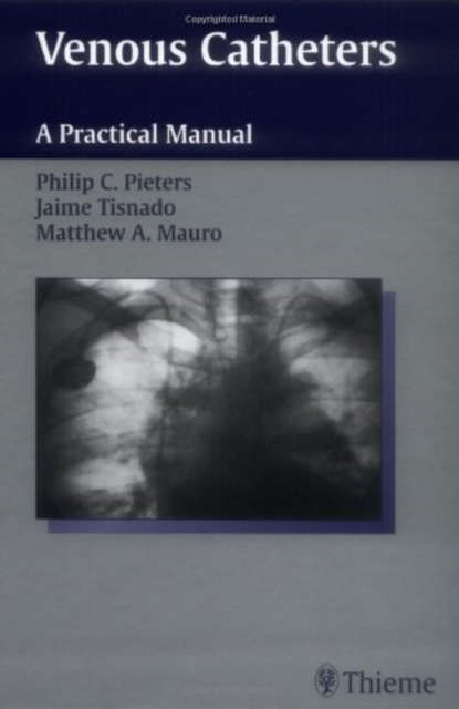 Venous Catheters : A Practical Manual, Hardback Book