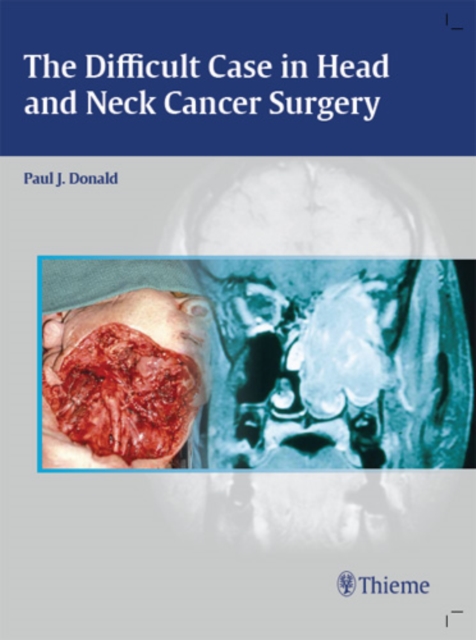 The Difficult Case in Head and Neck Cancer Surgery, Hardback Book