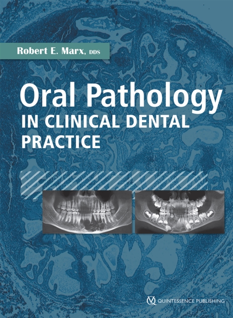 Oral Pathology in Clinical Dental Practice, PDF eBook