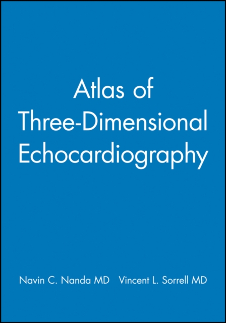Atlas of Three-Dimensional Echocardiography, Hardback Book