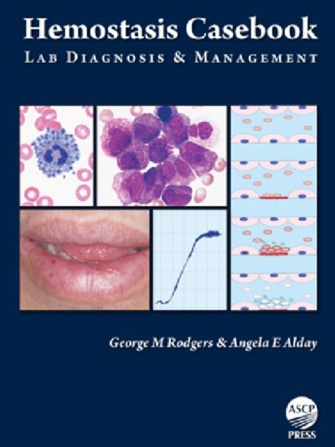 Hemostasis Casebook : Lab Diagnosis & Management, Hardback Book