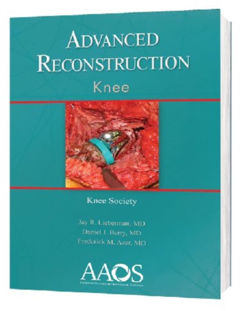 Advanced Reconstruction: Knee, Hardback Book
