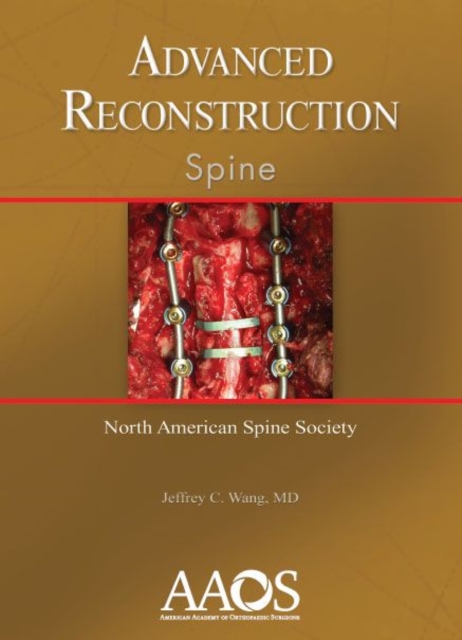 Advanced Reconstruction: Spine, Hardback Book