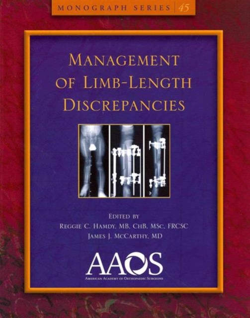 Management of Limb-Length Discrepancies, Paperback / softback Book