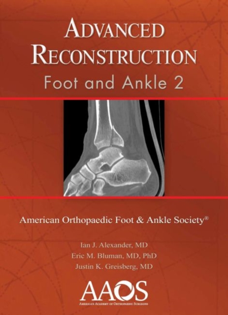 Advanced Reconstruction: Foot and Ankle 2, Hardback Book