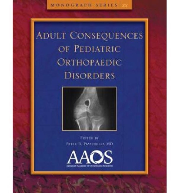 Adult Consequences of Pediatric Orthopaedic Disorders, Paperback / softback Book