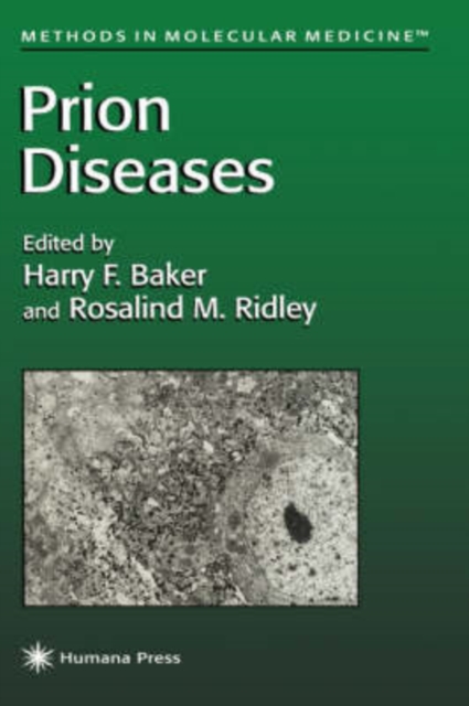 Prion Diseases, Hardback Book