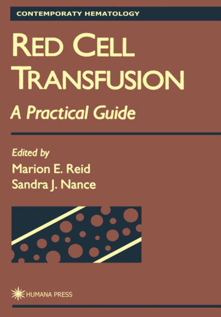 Red Cell Transfusion : A Practical Guide, Hardback Book