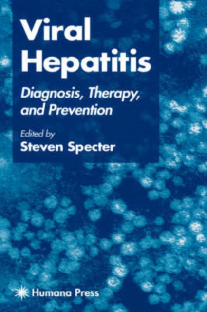 Viral Hepatitis : Diagnosis, Therapy, and Prevention, Hardback Book