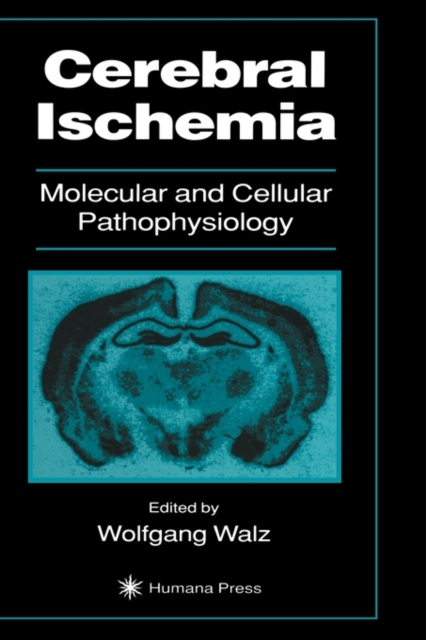 Cerebral Ischemia : Molecular and Cellular Pathophysiology, Hardback Book